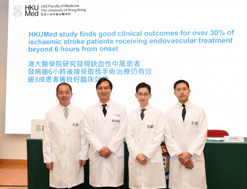 HKUMed research team finds that over 30% of ischaemic stroke patients who received intra-arterial mechanical thrombectomy had a good clinical outcome even after six hours of the onset of symptoms. (From left) Professor Gilberto Leung Ka-kit, Dr Chan Koon-ho, Dr Kevin Cheng King-fai and Dr Edward Chu Yin-lun.